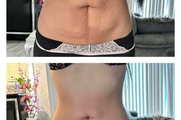 WhatsApp Image 2025-03-26 at 8.02.28 AM